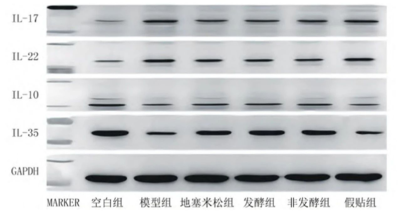 空白組和支氣管哮喘各組大鼠肺組織中IL－17、IL－22、IL－10、IL－35蛋白表達(dá)電泳圖